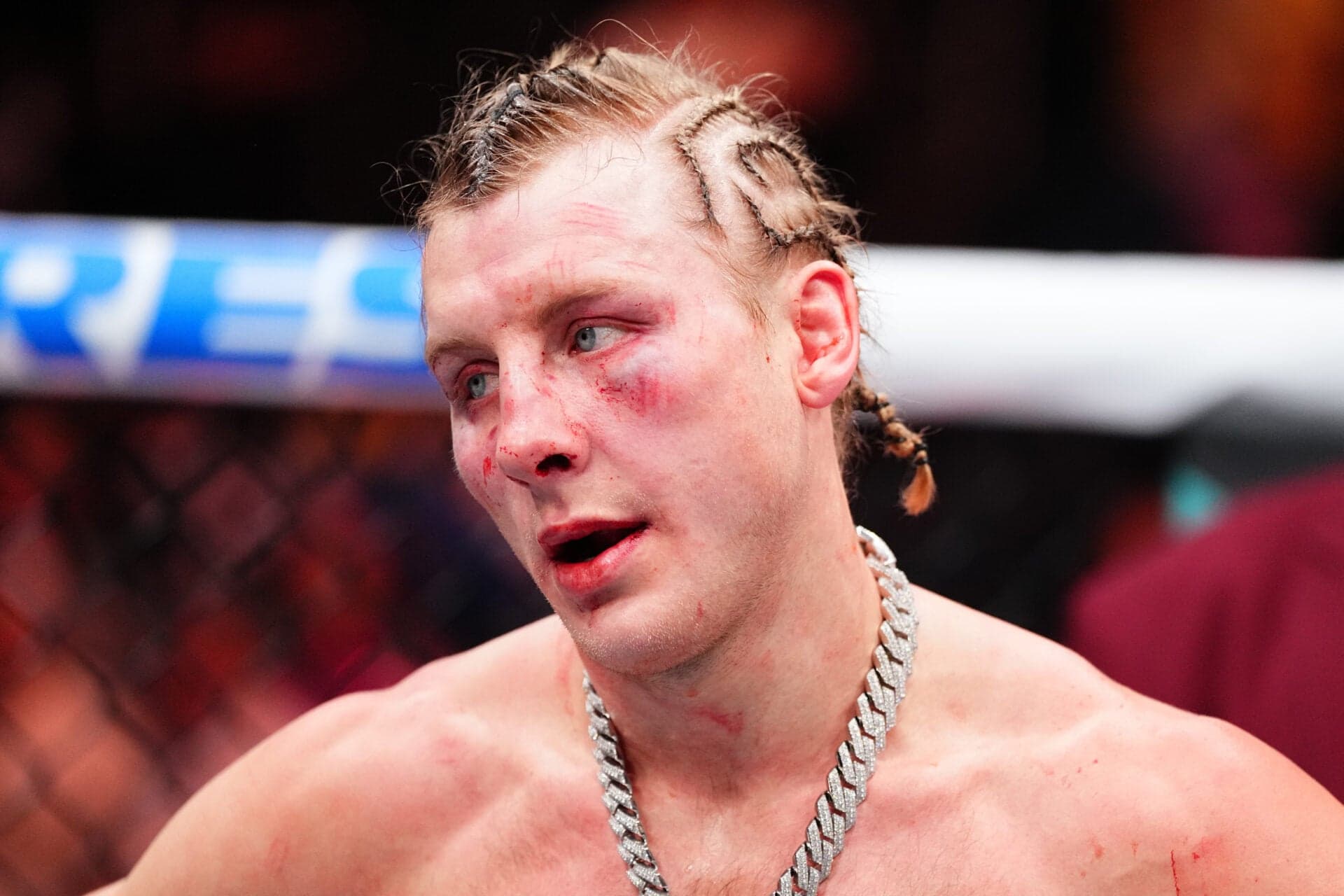 Paddy Pimblett health update provided by his wife after he was hospitalized following UFC 324 - Bloody Elbow