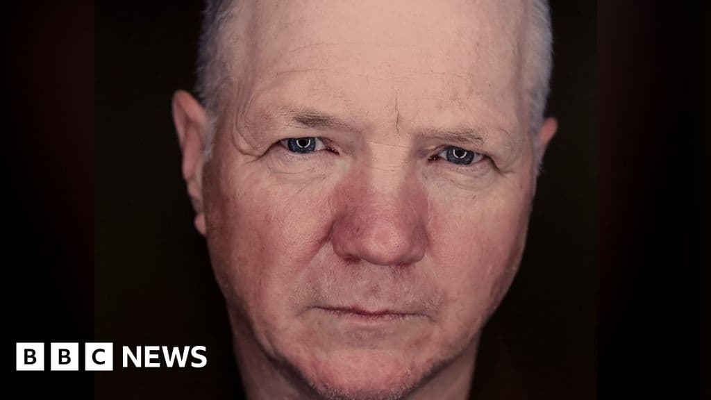 Haemochromatosis: Thousands in NI being offered testing for Celtic curse - BBC