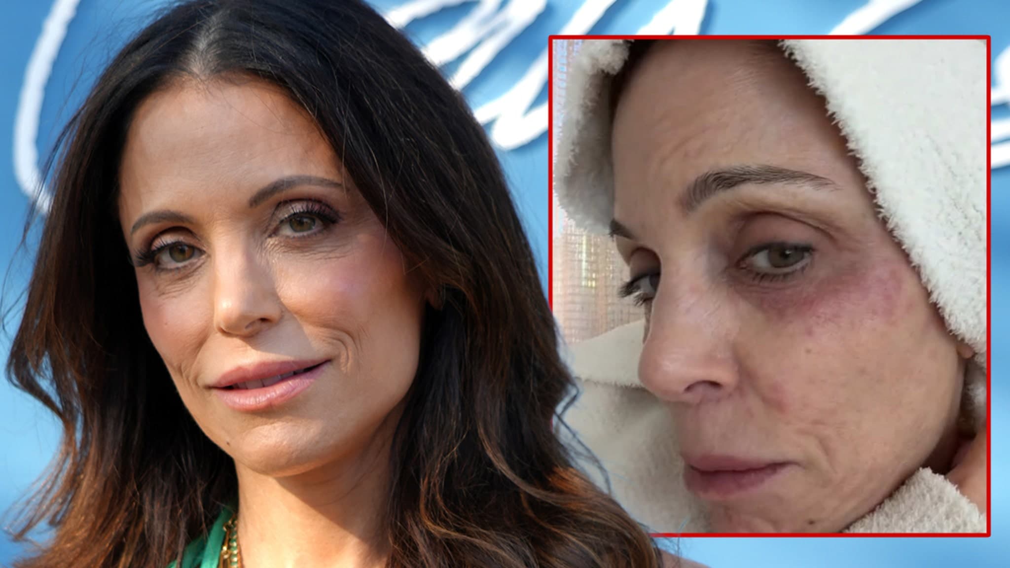 Bethenny Frankel Contracts Bacterial Infection After Partying in St. Barths - TMZ