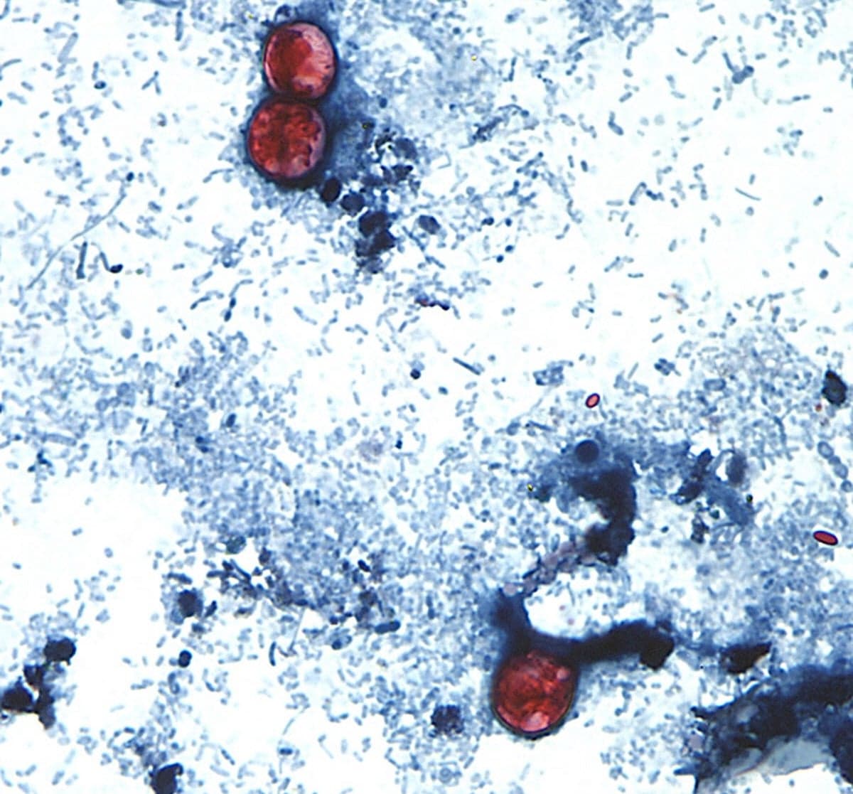 An intestinal parasite is causing ‘explosive’ diarrhea in Pa. and N.J. Here’s what to know about cyclospora - WHYY