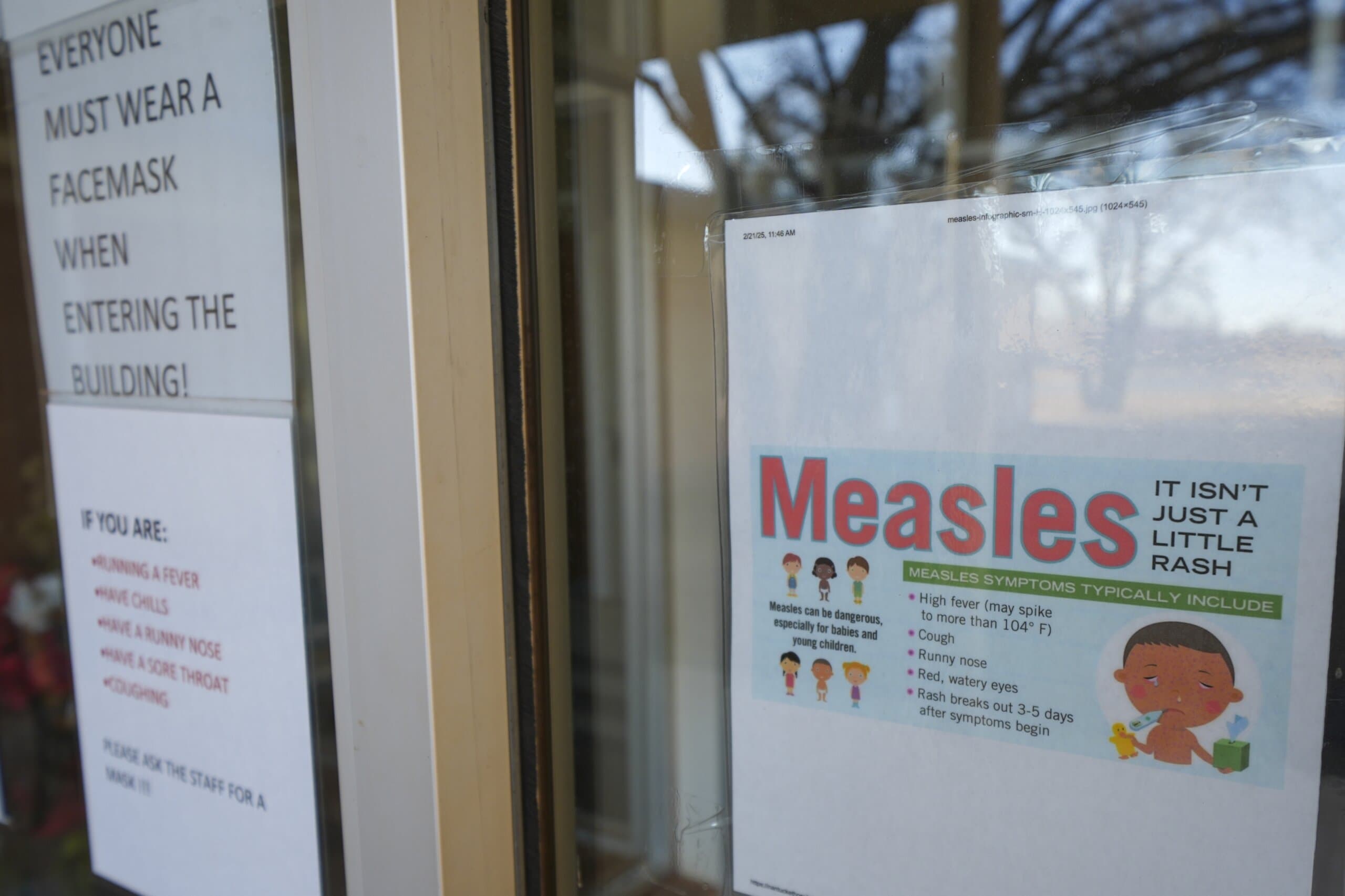 Adult with measles possibly exposed others in Fairfax County - WTOP